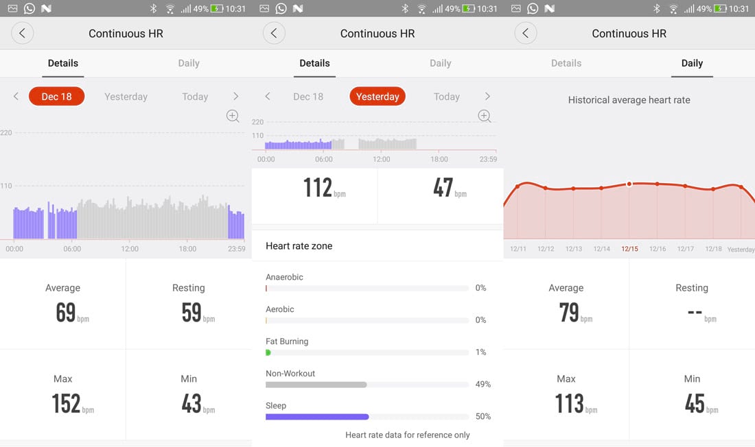 Cardiac monitoring screens