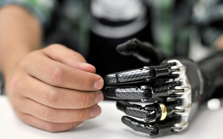 E-dermis allows sensation of touch and pain in bionic hand.