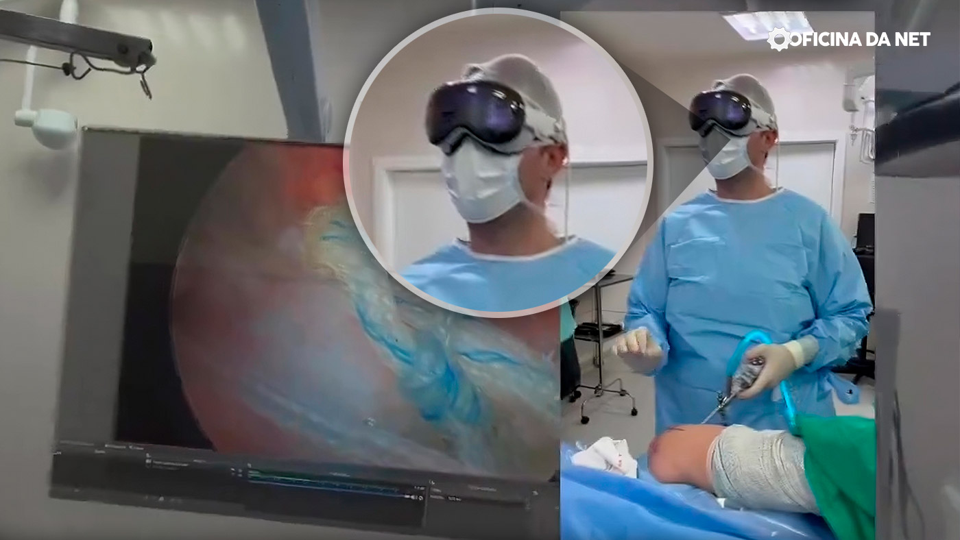 Apple Vision Pro usado em cirurgia no Brasil