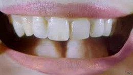 Cientistas usam urina humana para recriar dentes Cientistas usam urina humana para recriar dentes