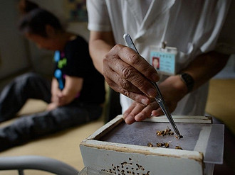 Picadas de abelhas sÃ£o usadas na China em sessÃµes de acupuntura