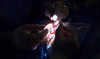 Paciente cega volta a enxergar após cirurgia realizada por médico brasileiro Paciente cega volta a enxergar após cirurgia realizada por médico brasileiro