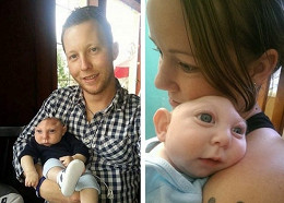 Conheça a história do bebê que nasceu sem uma parte do cérebro