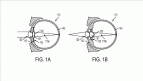 Google registra patente de mecanismo que é implantado no olho Google registra patente de mecanismo que é implantado no olho