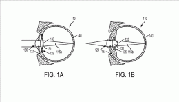 Google registra patente de mecanismo que é implantado no olho Google registra patente de mecanismo que é implantado no olho