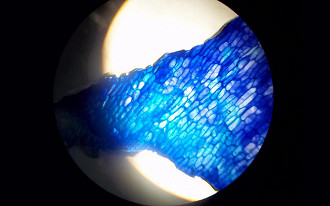 Foto das células de uma cebola vista pelo microscópio, foto tirada do celular. 