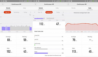 Telas do monitoramento cardíaco