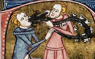 Não era fácil ir no dentista na Idade Média