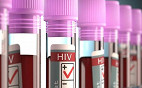 Pesquisadores norte-americanos conseguem remover totalmente vírus HIV de animais vivos Pesquisadores norte-americanos conseguem remover totalmente vírus HIV de animais vivos