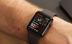 Apple Watch não é capaz de detectar Fibrilação atrial (FA) acima de 120bpm; falhas chegam a 60%