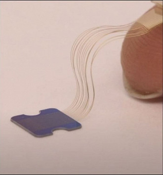 O tamanho de um chip de link Neuralink em comparação com o dedo mínimo da mão. (Foto: YouTube / Neuralink)