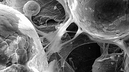 Nova técnica de impressão 3D de ligas de titânio inovará implantes biomédicos