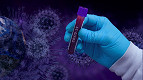 Nova cepa B.1.1.7 do Coronavírus já está no Brasil? Entenda a mutação do vírus