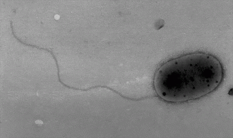 Cepa S2R03-9T Methylobacterium jeotgali sendo visualizada em micrografia eletrônica de transmissão. (Imagem: Aslam et al, Int. J. Syst. Evol. Microbiol. 2007)