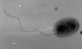 Cepa S2R03-9T Methylobacterium jeotgali sendo visualizada em micrografia eletrônica de transmissão. (Imagem: Aslam et al, Int. J. Syst. Evol. Microbiol. 2007) Cepa S2R03-9T Methylobacterium jeotgali sendo visualizada em micrografia eletrônica de transmissão. (Imagem: Aslam et al, Int. J. Syst. Evol. Microbiol. 2007)