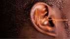 Como os fones de ouvido TWS e aparelhos auditivos irão monitorar sua saúde
