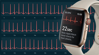 O smartwatch utiliza sensores para registrar a atividade elétrica do coração (Imagem: Reprodução/Internet)