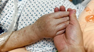 Avanço tecnológico na saúde trava na ponta e deixa populações vulneráveis para trás